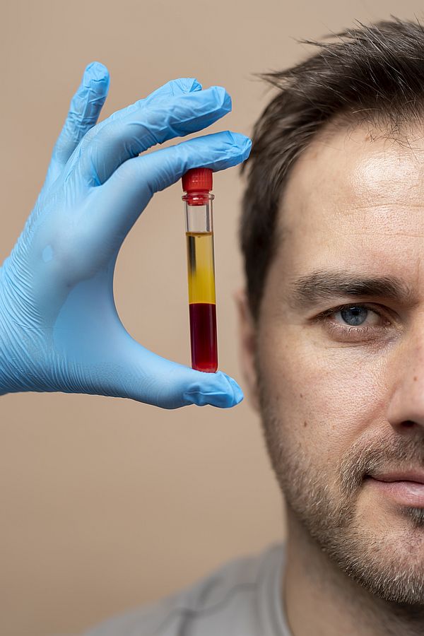 Plasma Rico en Plaquetas (PRP)